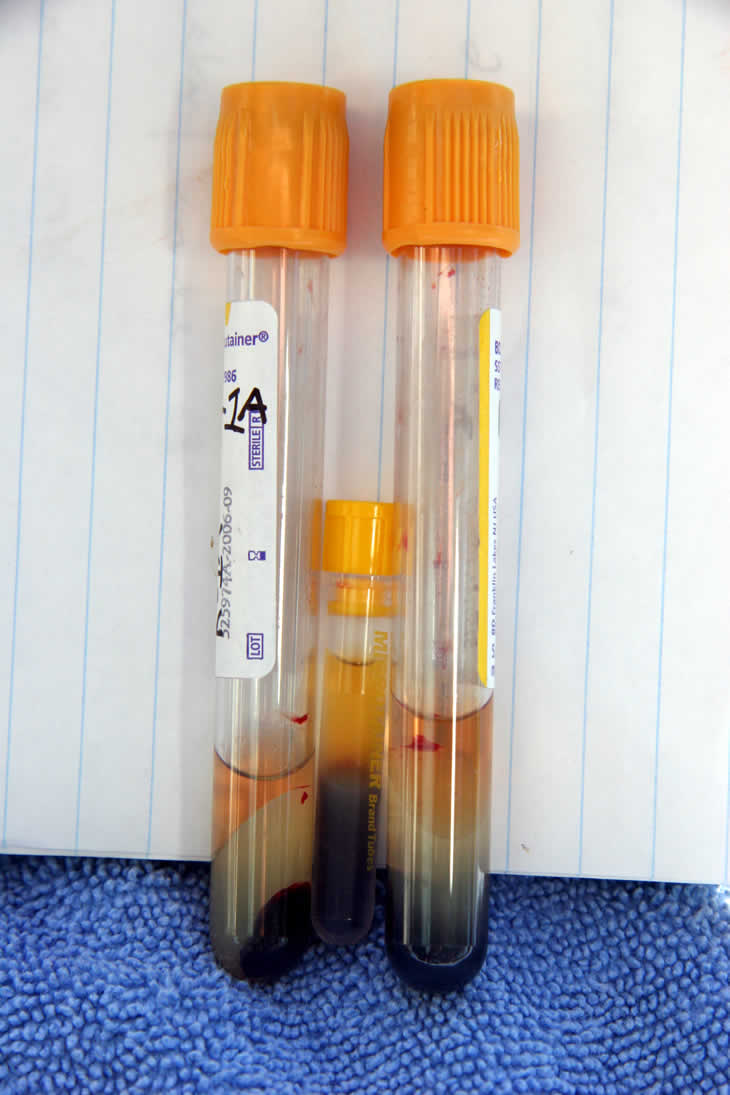 vacutainer and microtainer with sample after spinning